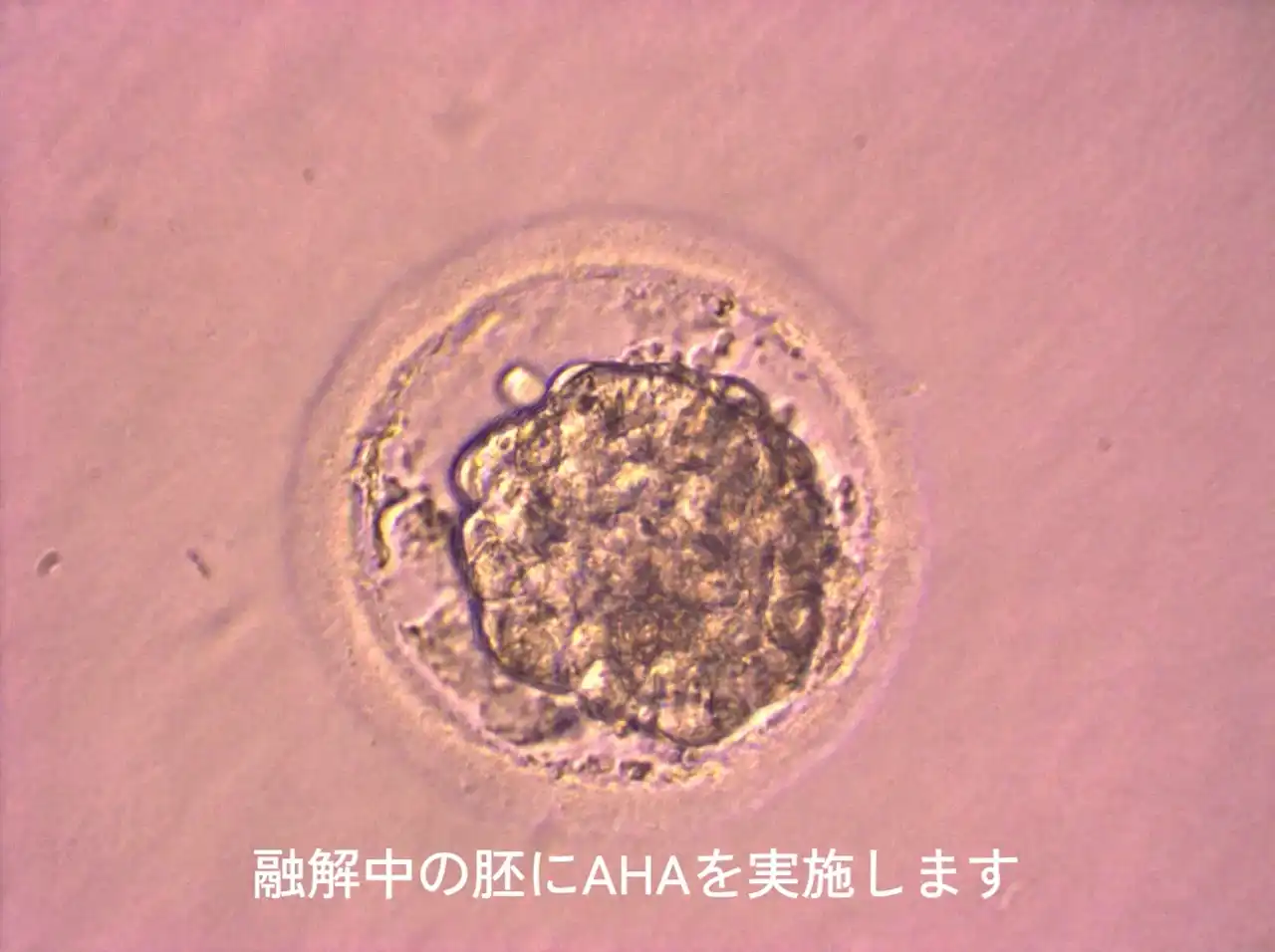 生殖補助医療(ART)について - 福岡ART(アート)クリニック