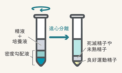 密度勾配法