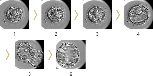 発育速度を胞胚腔(胚盤胞の中にできる液体の入った空間)の広がり具合で1~6段階に評価