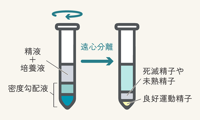 密度勾配法
