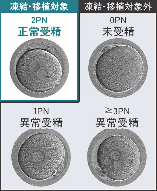 受精の観察