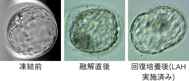 凍結胚融解