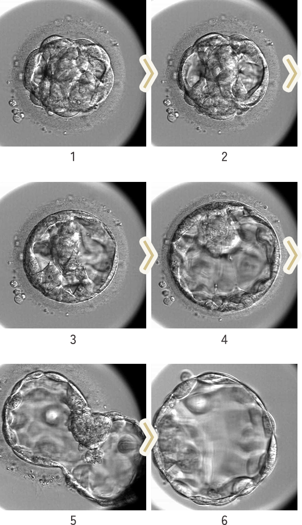 発育速度を胞胚腔(胚盤胞の中にできる液体の入った空間)の広がり具合で1~6段階に評価